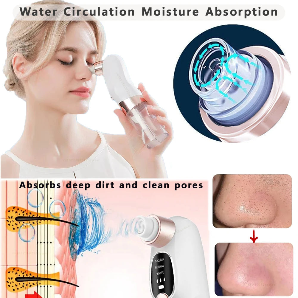 Blackhead Remover Vacuum – Electric Pore Cleaner Facial Skincare Tool