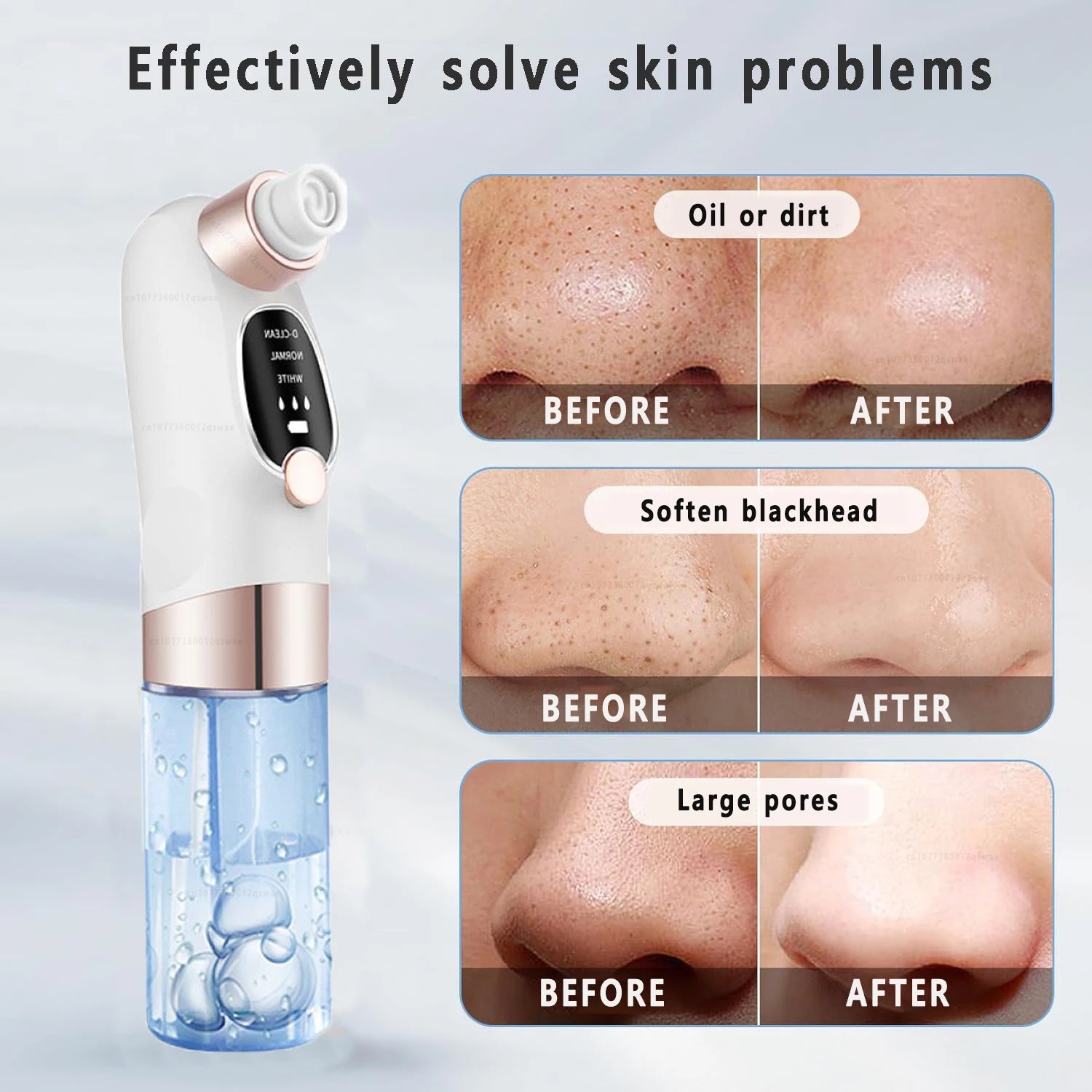 Blackhead Remover Vacuum – Electric Pore Cleaner Facial Skincare Tool