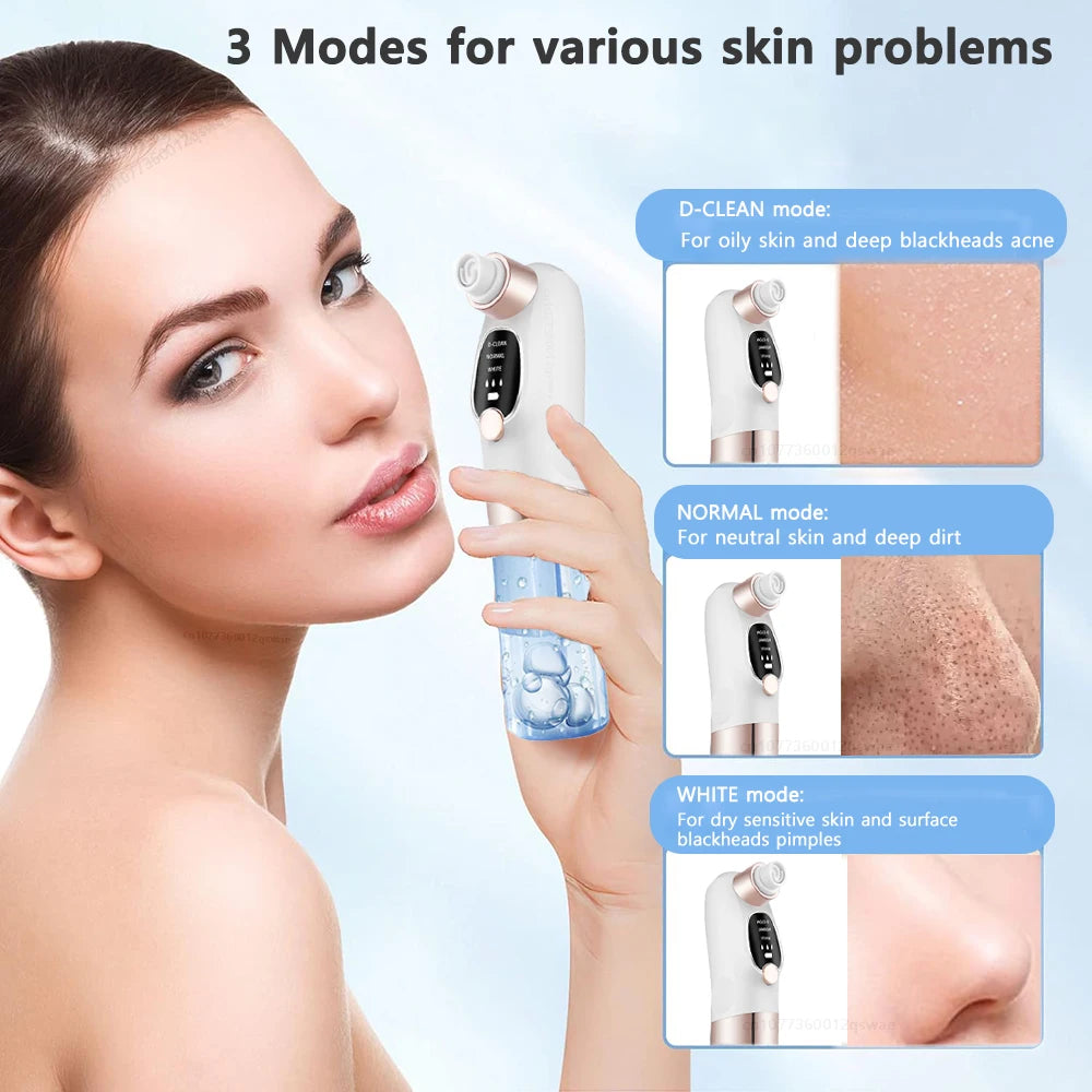 Blackhead Remover Vacuum – Electric Pore Cleaner Facial Skincare Tool