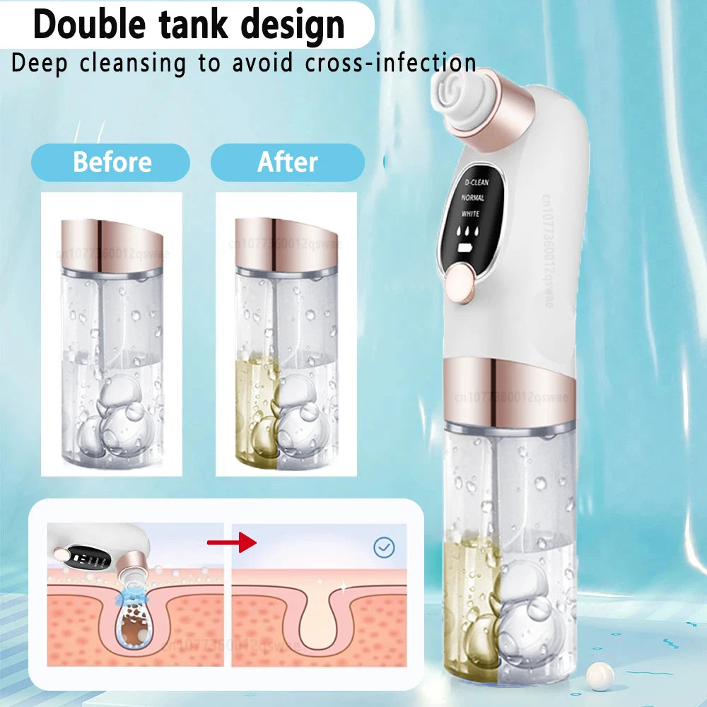 Blackhead Remover Vacuum – Electric Pore Cleaner Facial Skincare Tool